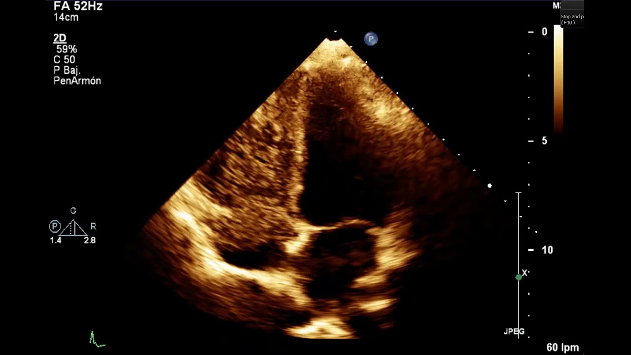 Heriberto Pruneda Ayala-23