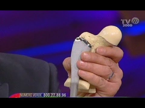 Dolore alla schiena durante lesecuzione di che cosa fare Se giunti crackle in coxartrosi