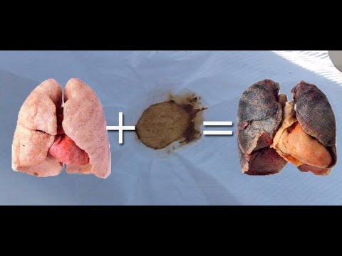 Prostatilen aumenta la potenza Quanta è lingrandimento del pene