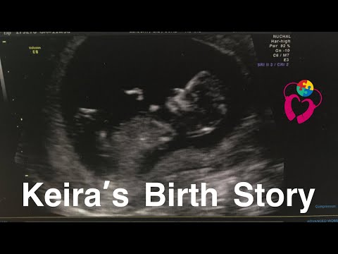 Keira's Birth Story - Autism VLOG - Keira's CMV Journey