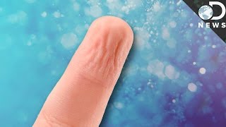 Why Do We Get Pruney Fingers In Water?