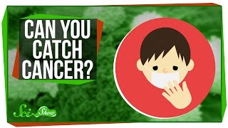 Can You Catch Cancer?