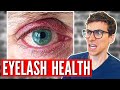 Why You NEED To Wash Your EYELASHES 5 Tips For Blepharitis