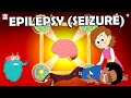 What Causes Epilepsy? | Seizures Explained | The Dr Binocs Show | Peekaboo Kidz