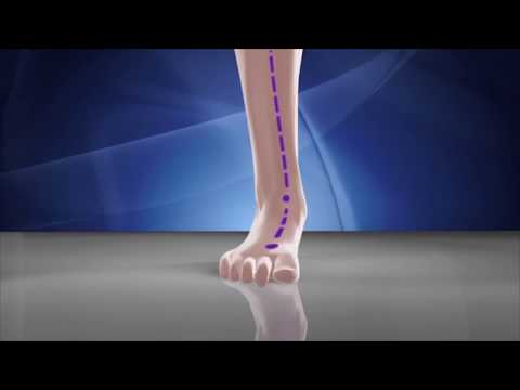 Sole Perfection Shoes has Aetrex