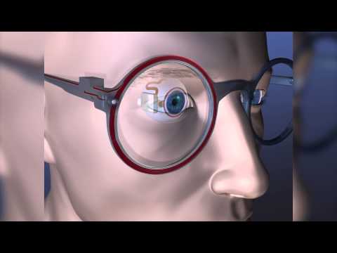 Artificial Retina Could Help Clear Your Vision