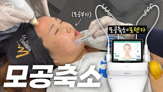 에이비 직원도 받습니다.