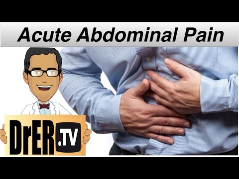 Acute Abdomen   PEV