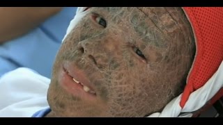 Children of Agent Orange