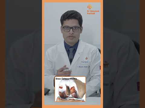 Osteoarthritis Overview in Hindi | Dr. Mayank Pathak