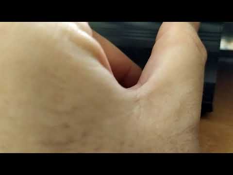 2m sporadic in im67mg 2.teil