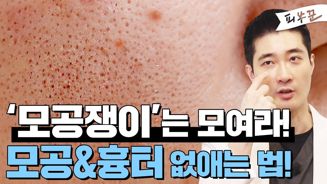 related_video_thumbnail