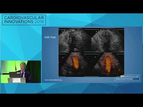 CVI2018 Session: CTO PCI for treating mitral regurgitation - M. Nicholas Burke, MD
