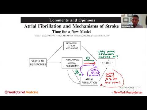WSA Webinar - ESUS: Latest advances and research priorities