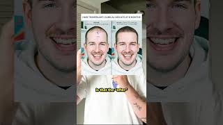 My Face is Being Used in an AI Scam  #politics #news #ai