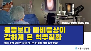 서울척탑병원, 발목마비가 온 척추질환 (디스크/협착증)