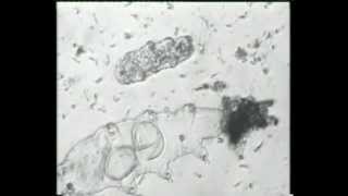 preview picture of video 'A journey to the world of invisible animals - Part 33: Embryos and birth of tardigrades'