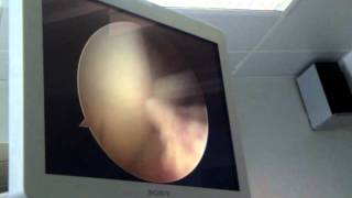 Maskinen käkar upp det trasiga i knät.