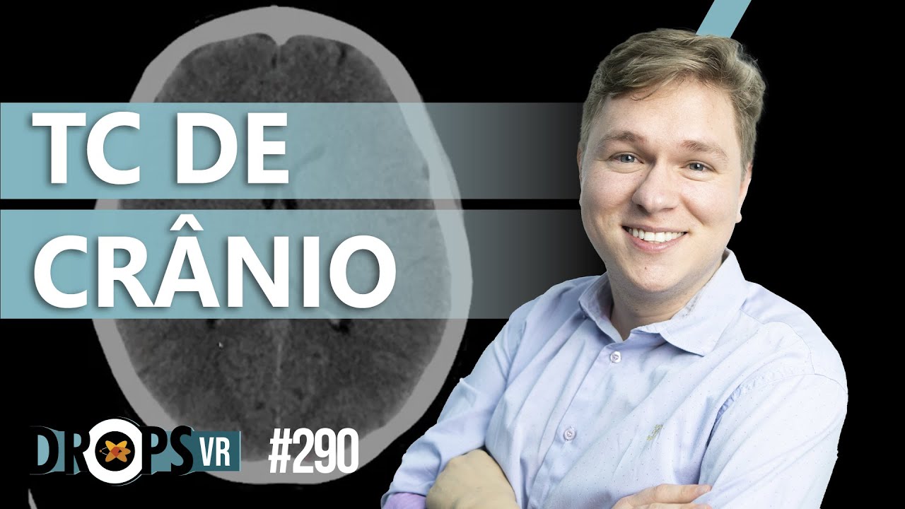 TC DE CRÂNIO - O QUE CONSEGUIMOS VER?