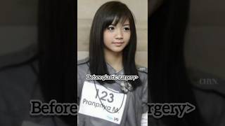 Download lagu Lisa before plastic surgery vs after plastic surgery ✨ #lalisa mp3