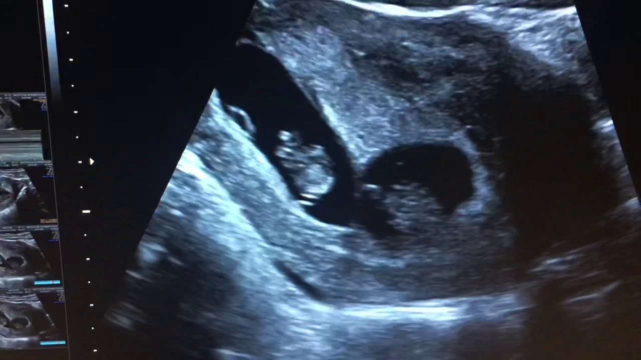 Gabriela Cabrera Lopez-41