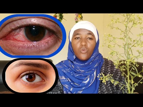 UMUTI UVURA AMASO AKABA UMWERU MUMINSI MIKE CYANEE, NTIYONGERA NO KUKURYA NAGATO