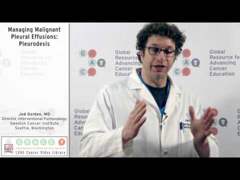 Managing Malignant Pleural Effusions: Pleurodesis