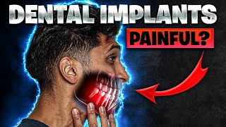 The Painful Truth About Dental Implants (No One Talks About This)