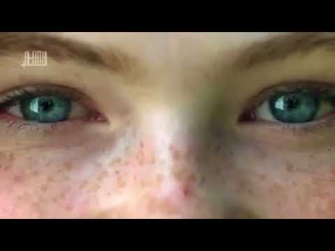 Отбеливание пигментных пятен касторовым маслом отзывы Подтягивающие кожу отбеливающие маски