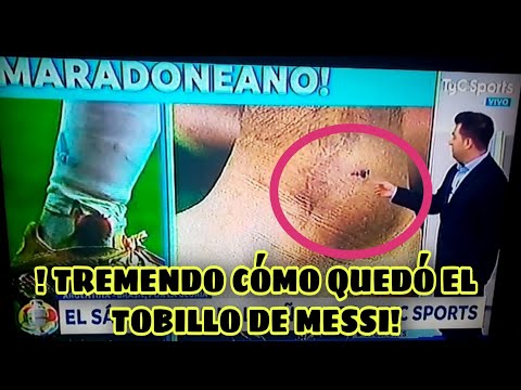 🌍TOBILLO SANGRENTADO DE MESSI LUEGO DEL PARTIDO CON COLOMBIA/SF ARGENTINA VS COLOMBIA-COPA AMÉRICA