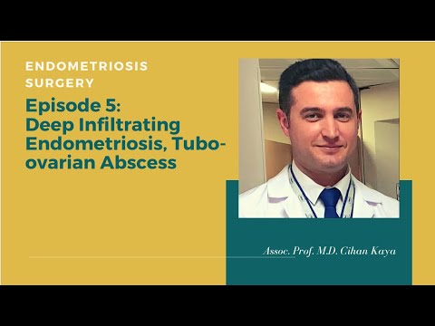 Deep Endometriosis