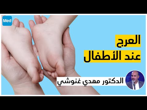 العرج عند الأطفال