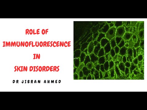 OSTEOGENIC TX II FLETCHERS 5TH E II ROBBINS 10TH E II POST GRADUATE LEARNING II DrJIBRANAHMED