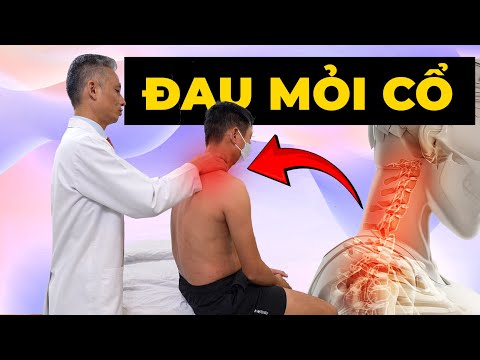 Tại Sao Bạn Đau Cổ Mãi Không Khỏi? Sai Lầm Chết Người 90% Người Mắc