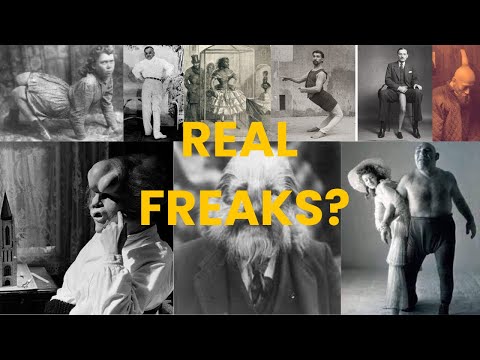 The 10 Most Grotesque Human Oddities in History!