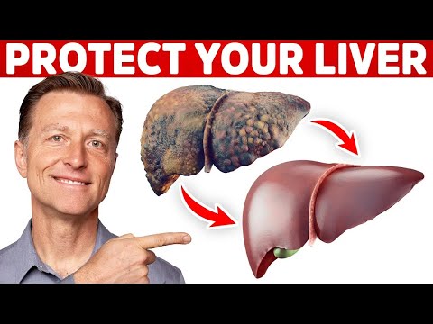 How Your Feet Are Warning You About Your Liver Problems Dr Berg Explains