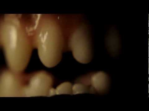 REMOVE SILENCE - Wormstation (Official Video)