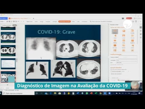 Comissão debate uso de exames de imagem para identificar pacientes com Covid - 27/05/20