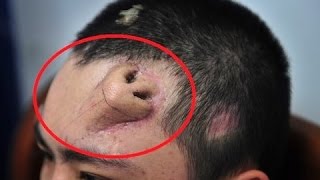 TOP 5 Cirugías Más Increíbles Que No Creerás Que Existen || TOP 10 VÍDEOS