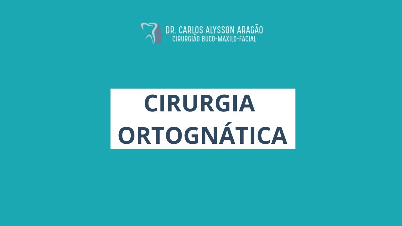 Carlos Alysson Aragão-61