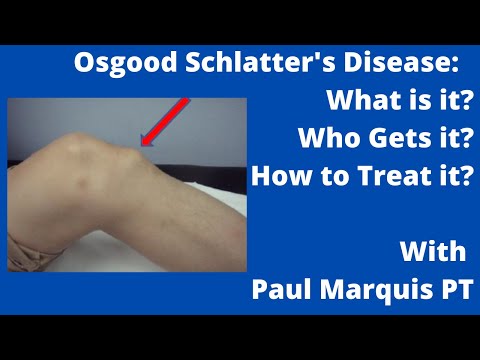 Osgood Schlatter's Disease: What is it? Who Gets it? How to Treat it?