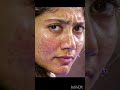Sai Pallavi Acne Face Closeup
