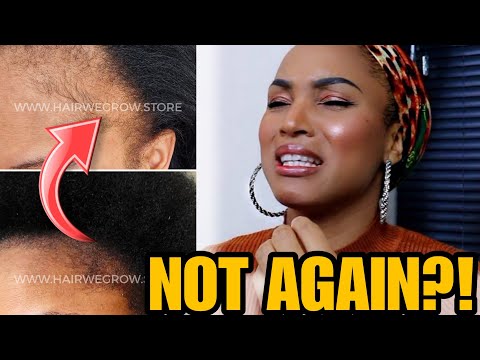 I miei bordi sono ricresciuti...e poi sono caduti di NUOVO!