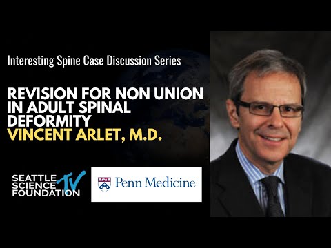 Revision for Non Union in Adult Spinal Deformity - Vincent Arlet, M.D.