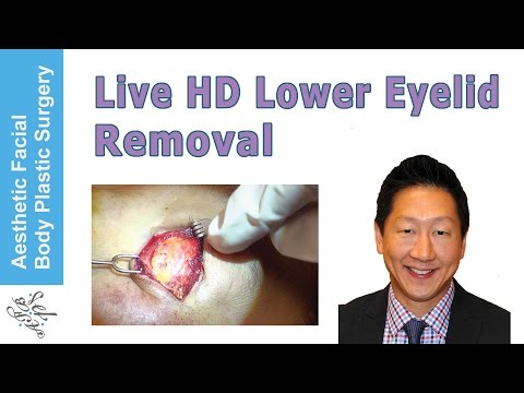 Maaari ko bang kumuha ng Reduxine hapon Komplivit radiance review pumayat