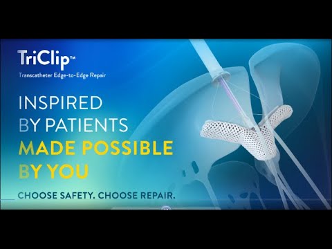 TriClip G4 TEER: Advanced Tricuspid Valve Repair