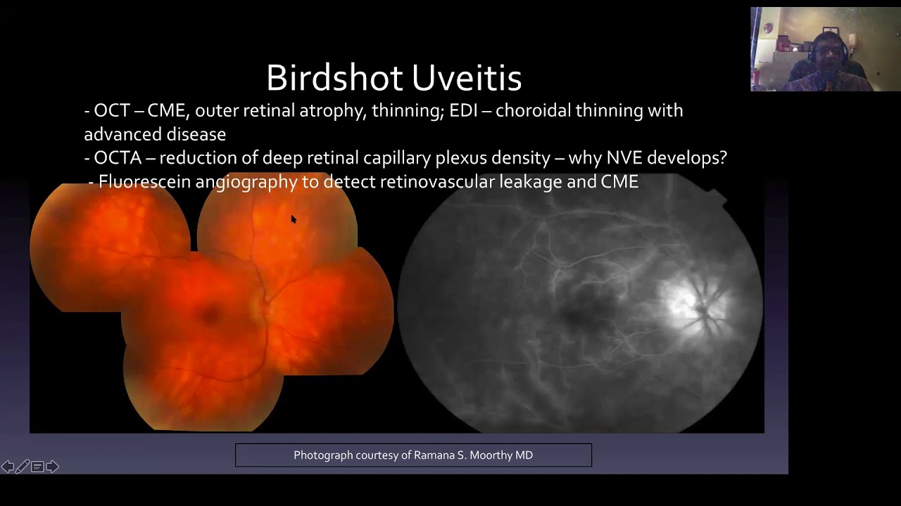 Update on White Spot Syndromes - YouTube