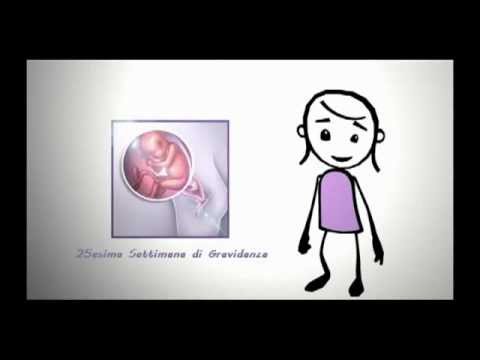 Ossessioni con osteocondrosi Esercizio dannoso in osteocondrosi