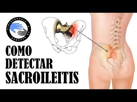 Pérmico refuerzo para la rodilla Cabra articulaciones inflamadas