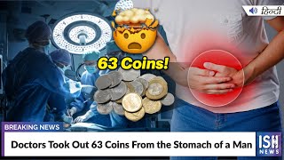 Doctors Took Out 63 Coins From the Stomach of a Man
